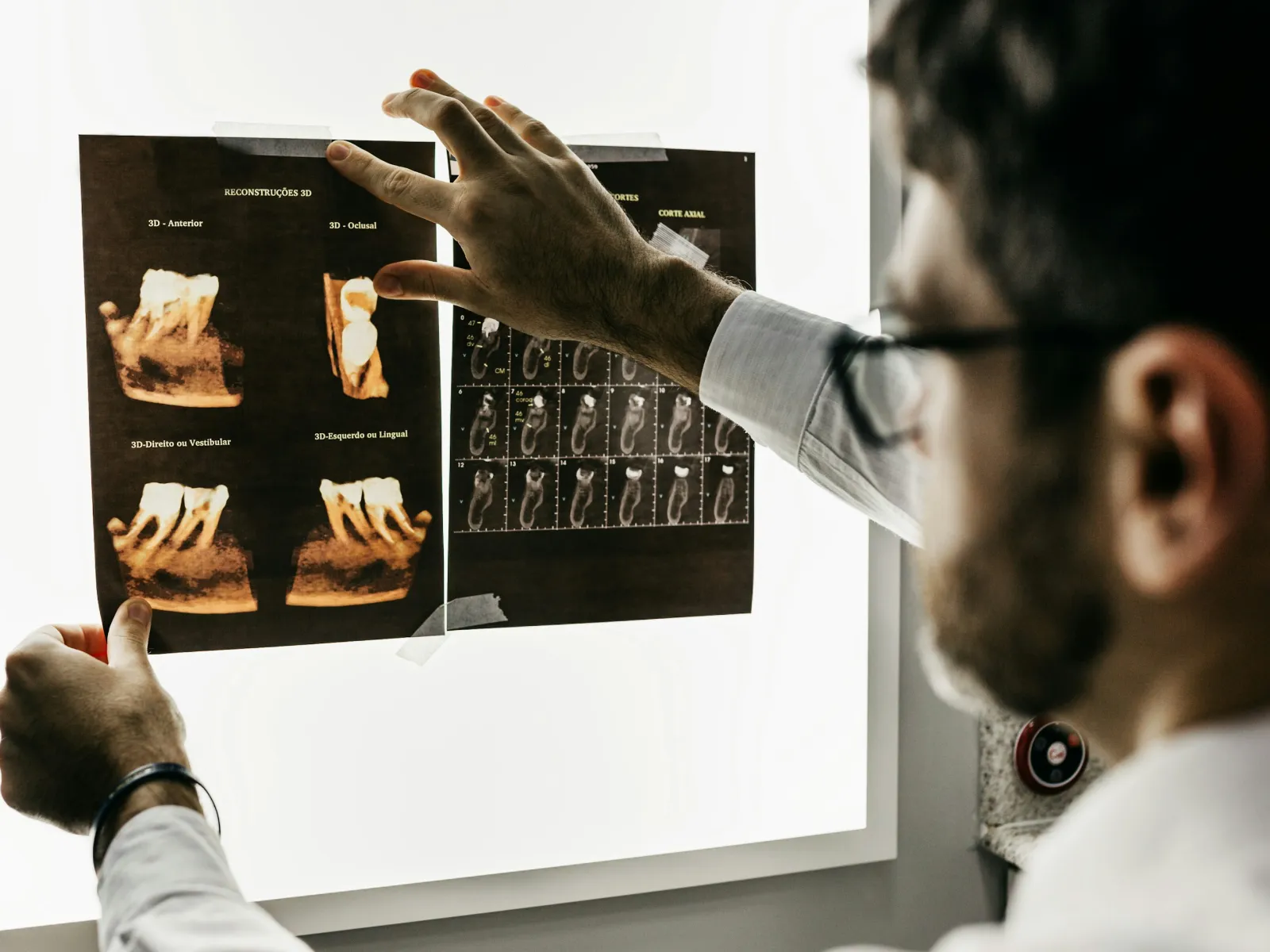 Dentist examining detailed 3D dental X-rays on a lightbox in a clinical setting